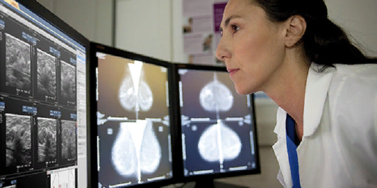 Для чего нужны маммографы и их разновидности
