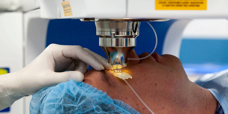 Проведение лазерной коррекции зрения и ее достоинства