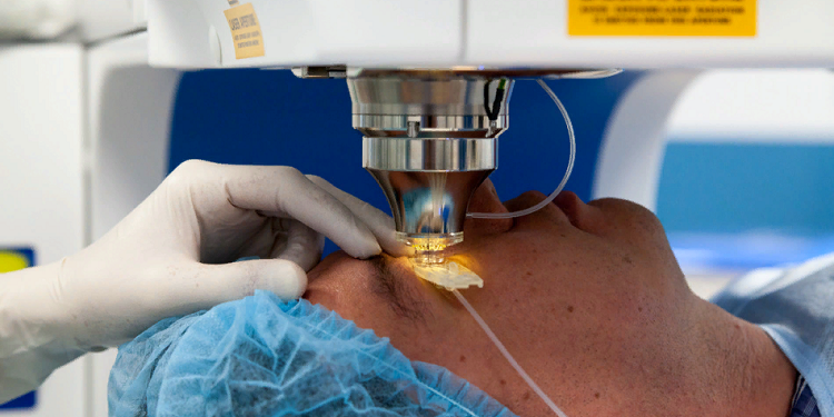 Особенности проведения лазерной коррекции зрения