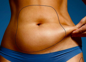 Підтяжка живота і вікові обмеження: молодість і пружність