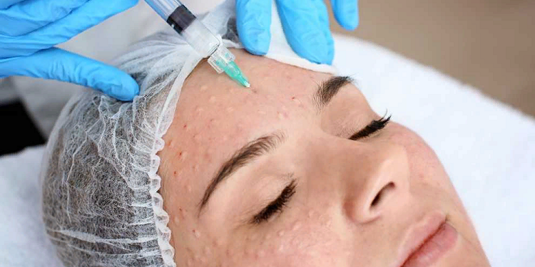 Подробности про биоревитализацию в косметологии