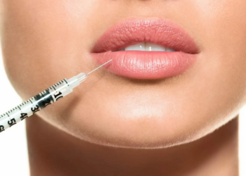 Как правильно использовать филлеры гиалуроновой кислоты и их плюсы