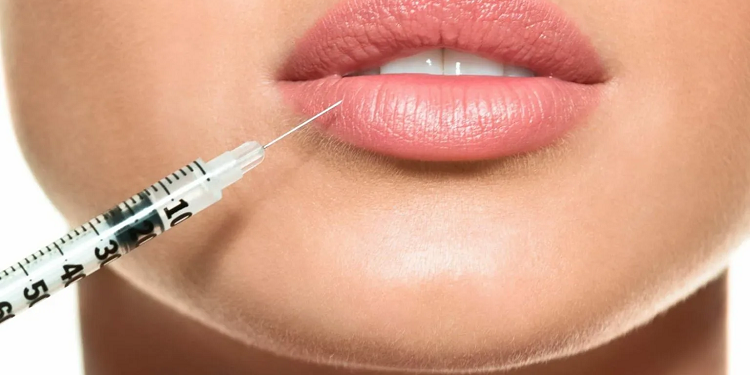 Как правильно использовать филлеры гиалуроновой кислоты и их плюсы