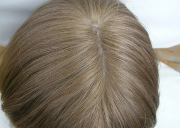 Натуральные парики с имитацией кожи головы: достоинства и описание