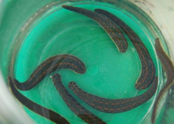 Особенности лечения пиявками и несколько важных правил