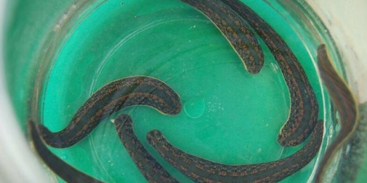 Особенности лечения пиявками и несколько важных правил