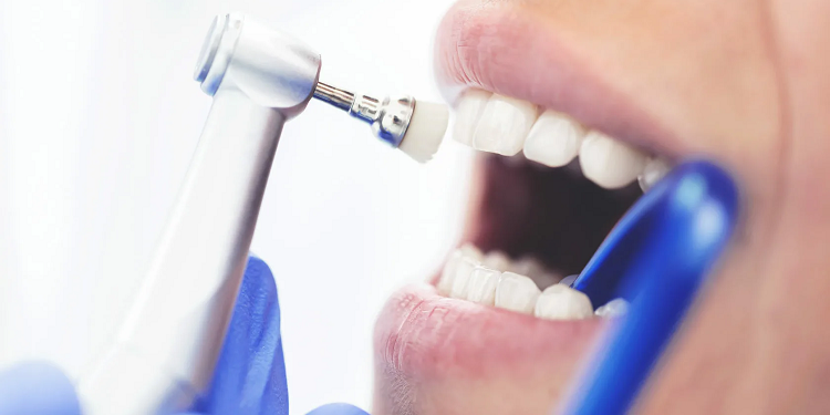 Професійна гігієна порожнини рота: що потрібно знати та правила