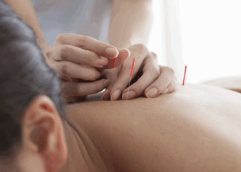 Иглоукалывание для кодирования от алкоголизма: достоинства и правила