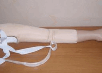 Как выбрать протез при вычленении в плечевом суставе