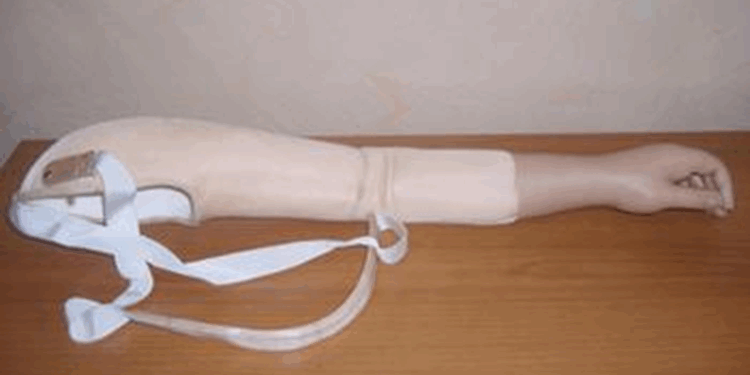 Как выбрать протез при вычленении в плечевом суставе