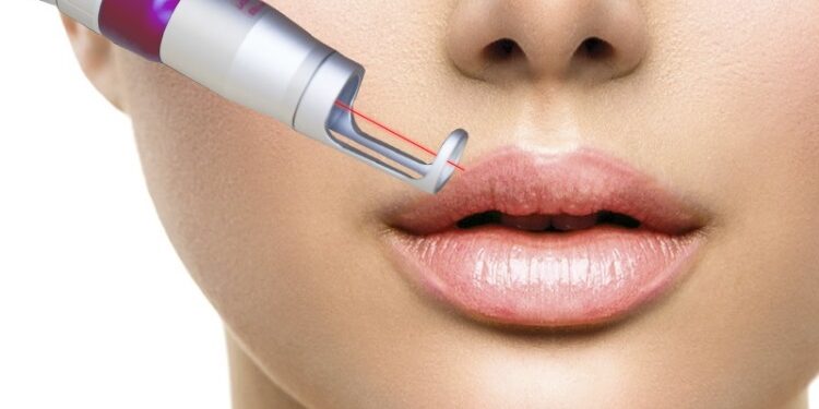 Правила безопасного и эффективного использования лазера для удаления татуировок и татуажа